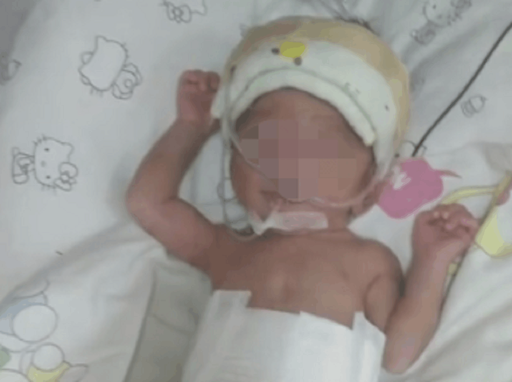 孕妇剖腹产当天发现患癌, 生产后28天离世: 未能看孩子一眼