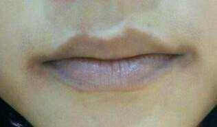 「」男人嘴巴“3个信号”，提醒肾脏已出现了问题，没中就偷乐吧！