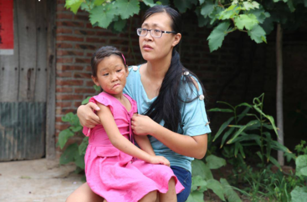 心疼！妈妈“夺”走女儿的脸，女孩渴望可以摘下自己的“面具”