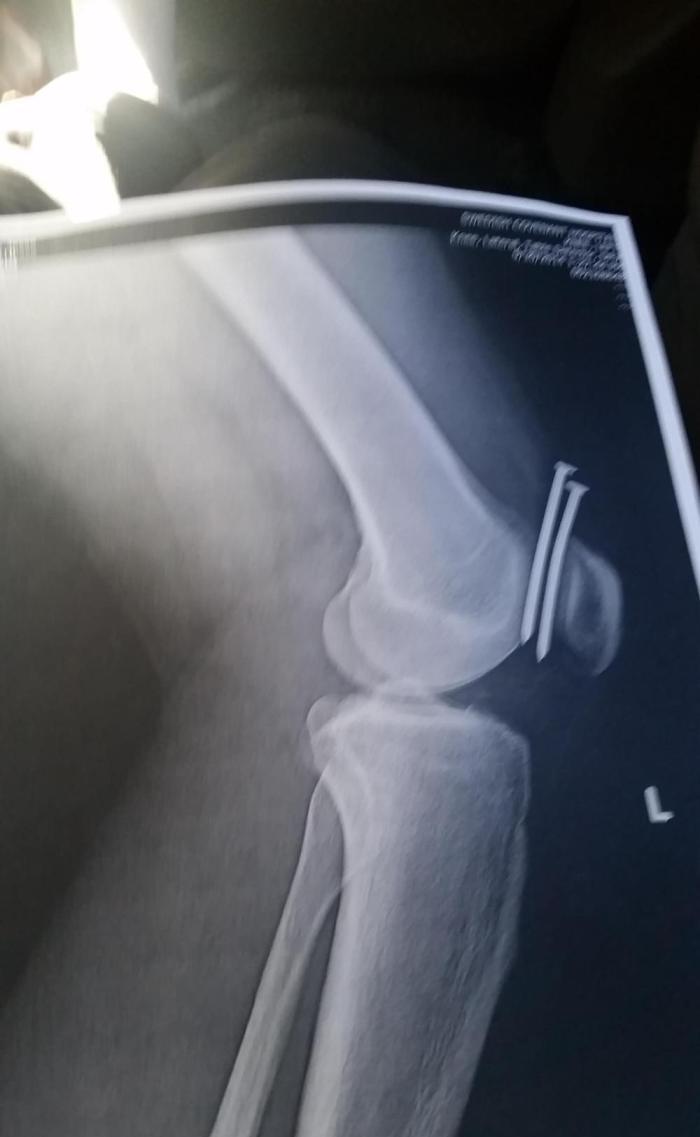 一组照片告诉你什么叫“福大命大”