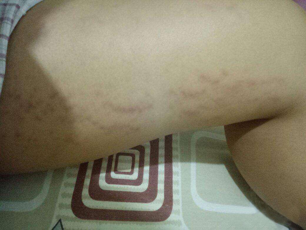 导语:怀孕生娃最怕什么?一肥胖,二入乳房下垂,三妊娠纹.