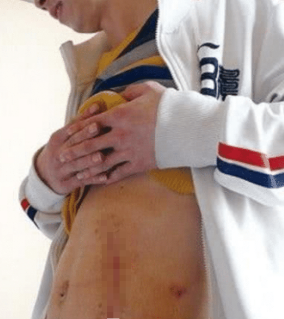 曾经“卖肾”买苹果手机的男生, 如今8年过去, 他的生活苦不堪言
