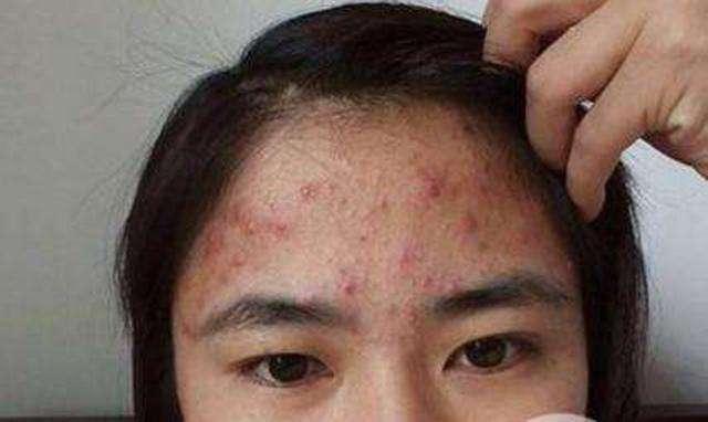 家里螨虫超级多？只需一根草，不到1毛钱，螨虫全部死光光