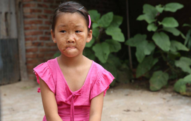 心疼！妈妈“夺”走女儿的脸，女孩渴望可以摘下自己的“面具”