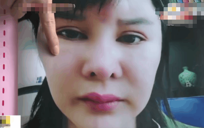 女子花27萬整容, 1年后卻發現自己的胸沒了, 醫院的做法讓人驚了