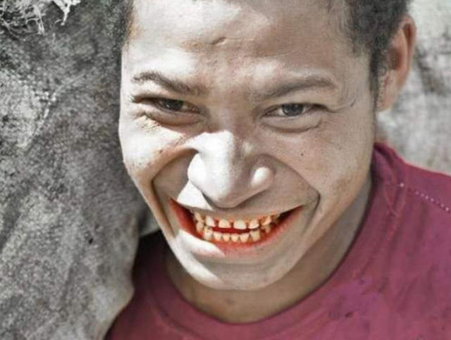 肾虚|你老公是不是肾虚就看脸上3个特征,不超过2个的,绝对是肾虚!