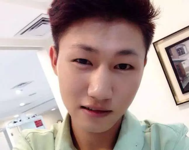 脱发:“雄性激素”不足的男生,身上或有这“3特征”,你男票中招了吗?