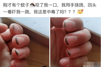 “蚊子咬了我一口，我用手挠了以后就这样了，难道这蚊子有毒？”