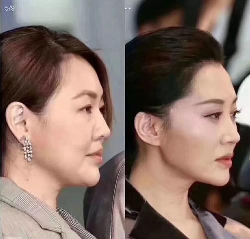 许晴|有种“尴尬”叫小S碰上许晴，2人同框照曝光后，网友：这是见过最惨烈的对比！