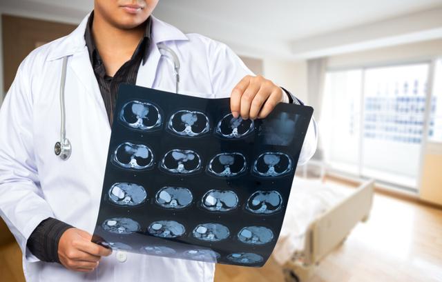 尿毒症|肝癌多是“拖”出来的?提醒:睡觉出现这4种表现,就要注意了