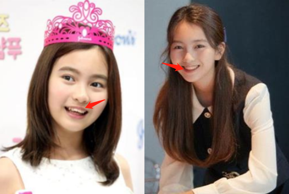 葛素媛|曾经全网为她哭瞎眼，如今带着一张惊艳众人的脸杀回来了
