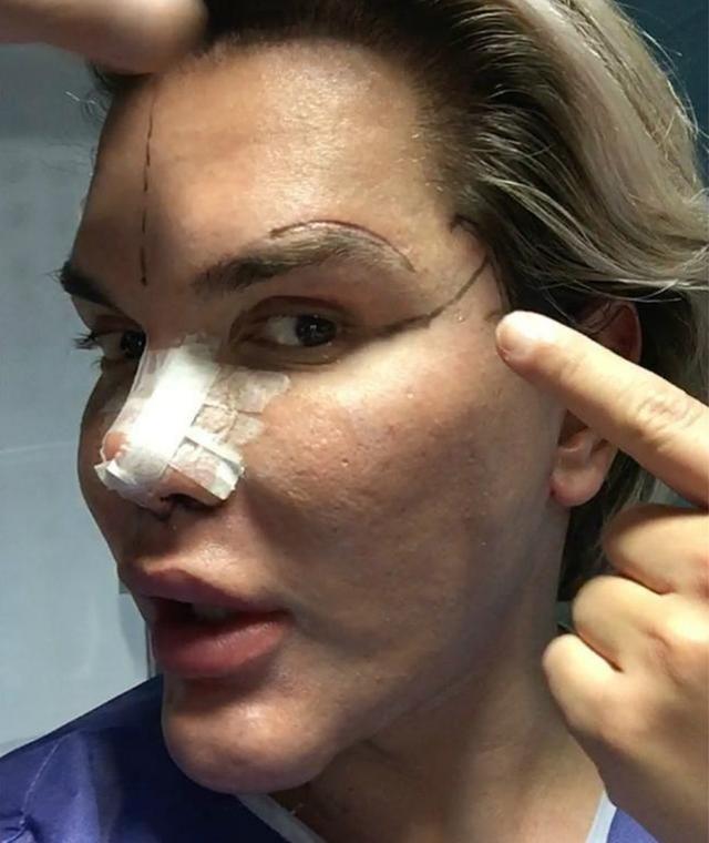 被称“行走的硅胶”,整容160次拆4根肋骨,对警察撒娇卖萌!