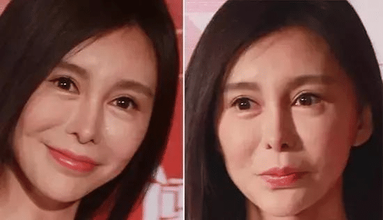 |继“玻尿酸”后，这款公认的“抗衰老”精华液火了，高质低价不输兰蔻