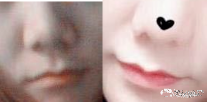 一条小团团|斗鱼一姐小团团露脸直播，颜值、体重双双翻车，这是第二个乔碧萝？