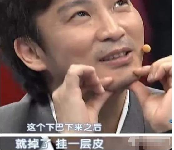 张雨绮|1998年，陈少华被伴舞“刺杀”，下巴脱落缝130针，今卖马桶为生