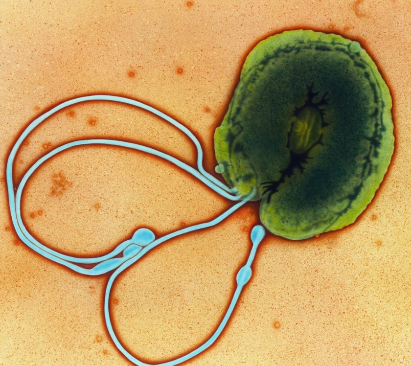 大脑|消化科医生:胃病患者,饭后1件事,坚持1个月,胜过吃胃药