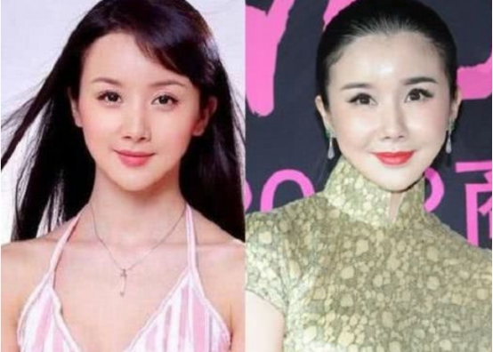 整容|4位“瞎整容”的女星，前3位很惋惜，最后一位花千万整成怪物