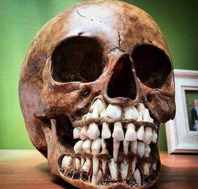 传家宝竟是外星人头骨，DNA检测头骨基因，发现人类跟外星人结合