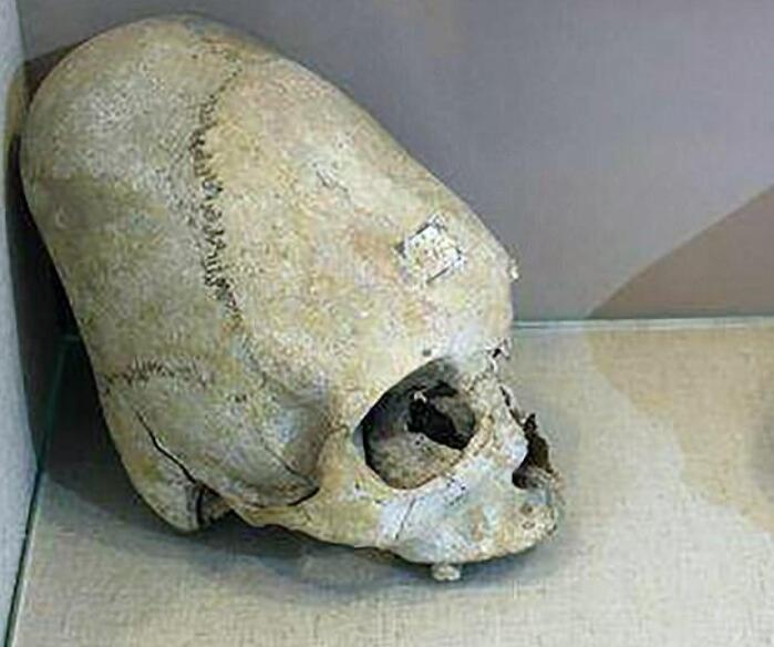 传家宝竟是外星人头骨，DNA检测头骨基因，发现人类跟外星人结合