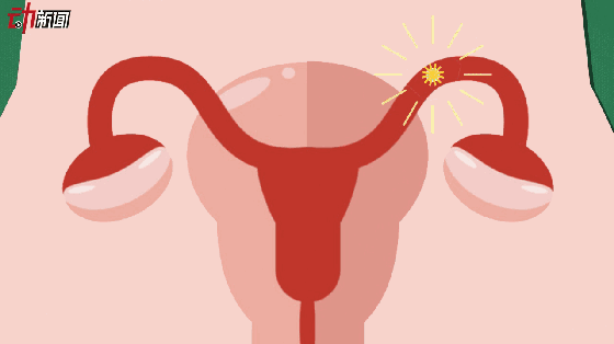 560_314gif 动态图 动图