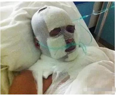 张雨绮|1998年，陈少华被伴舞“刺杀”，下巴脱落缝130针，今卖马桶为生