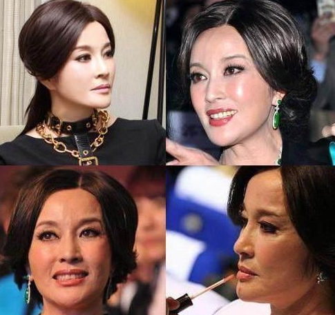 王心凌|被玻尿酸毁了的四大女星，王心凌像老太太，而她丑到不可接受