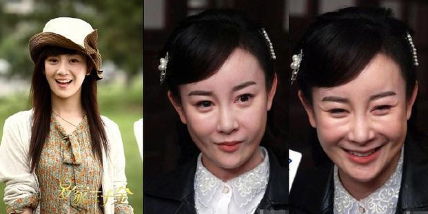 王心凌|被玻尿酸毁了的四大女星，王心凌像老太太，而她丑到不可接受