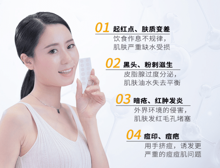 王源脸上痘痘越发严重 网友 再不戒烟 美颜滤镜都救不了你 娱乐 潮牌淘 最新潮流前沿潮牌时尚潮流品牌资讯 王源脸上痘痘越发严重 网友 再不戒烟 美颜滤镜都救不了你 娱乐 潮牌淘 最新潮流前沿潮牌时尚潮流品牌资讯