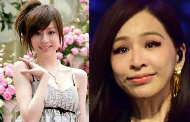 王心凌|被玻尿酸毁了的四大女星，王心凌像老太太，而她丑到不可接受