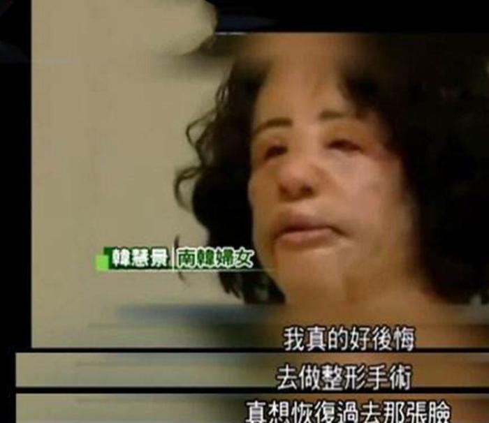 整容|她天生丽质却痴恋整容，后因意外导致毁容，去世时年仅57岁