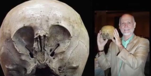 传家宝竟是外星人头骨，DNA检测头骨基因，发现人类跟外星人结合