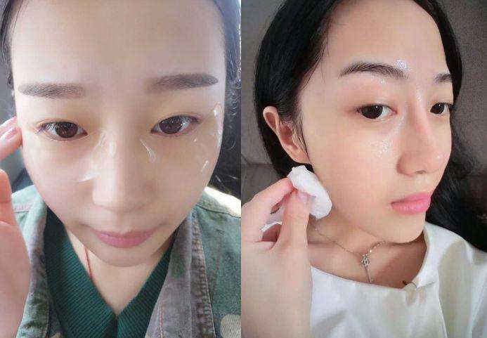 面膜|敷完面膜，脸上多余的“精华”真的要洗？还有人不听劝，难怪烂脸