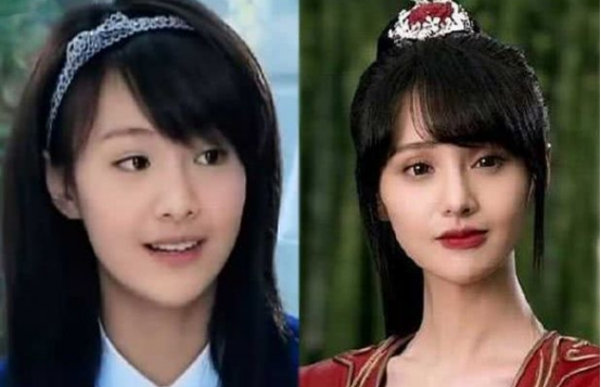 整容|4位“瞎整容”的女星，前3位很惋惜，最后一位花千万整成怪物