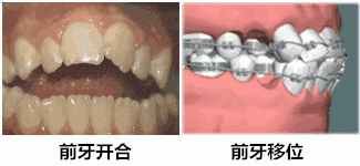葛素媛|曾经全网为她哭瞎眼，如今带着一张惊艳众人的脸杀回来了