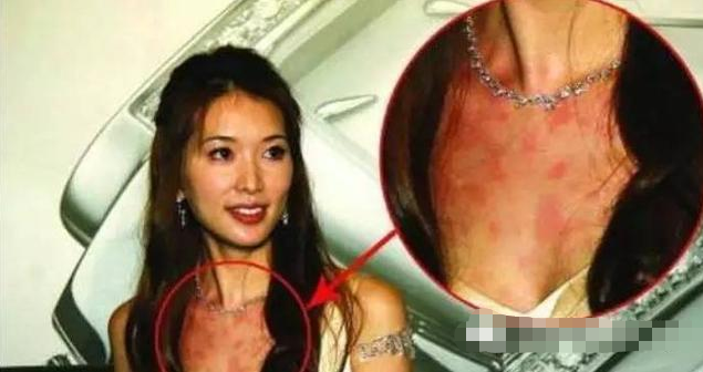 林志玲|4位明星酒后丑态,林志玲最狼狈,而她直接醉倒在红毯上