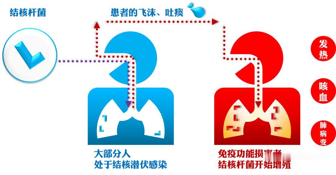 肺结核|22人感染,43人异常!一大学爆发聚集性疫情
