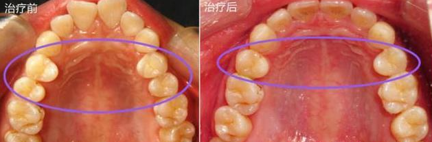葛素媛|曾经全网为她哭瞎眼，如今带着一张惊艳众人的脸杀回来了
