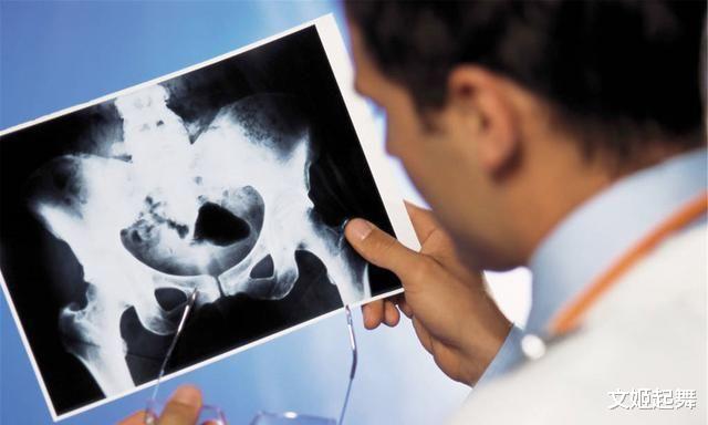 红枣|稳固骨质的“冠军”找到了，不是牛奶，没事敞开吃，提高骨密度