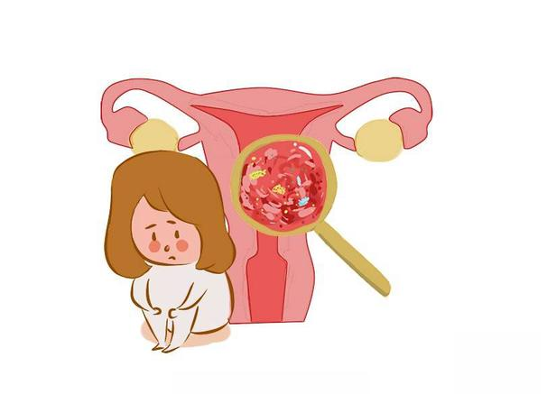 叙说人生故事 医生：女性腹部一旦出现2种迹象，说明子宫癌已来临，需尽早排查