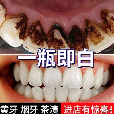 时尚好物官 有一种“低调”叫益生菌牙膏，用后牙黄牙垢掉光光，很多人都在用