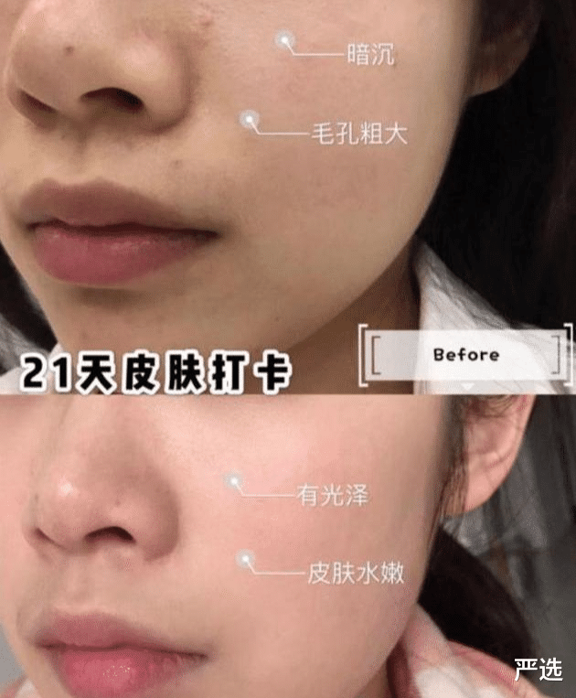 穿衣搭配 张嘉倪晒出“续命”精华液，李佳琦：我都用5年了，堪称平价SK - II