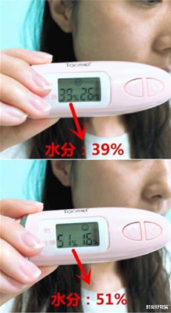 戚薇|一个被玻尿酸毁了的女星，如今38岁面目全非，年轻时五官精致耐看