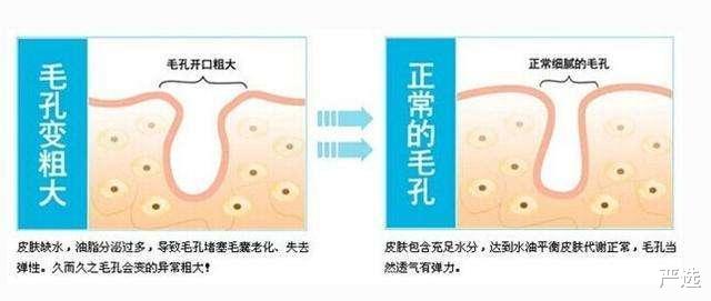 严选 继注射\＂玻尿酸\＂后，中国又一“抗衰老”方式走红，即安全还方便