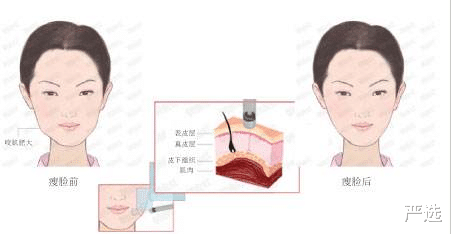 严选 球球整容前后对比，看着皮肤细腻状态好，终于摆脱“鞋拔子”脸了