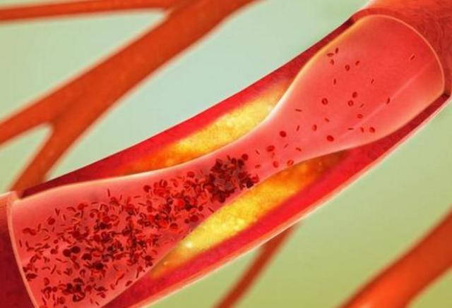 医生|一种零食正偷偷摧毁你的胰岛,医生建议:不管男女,都要少吃