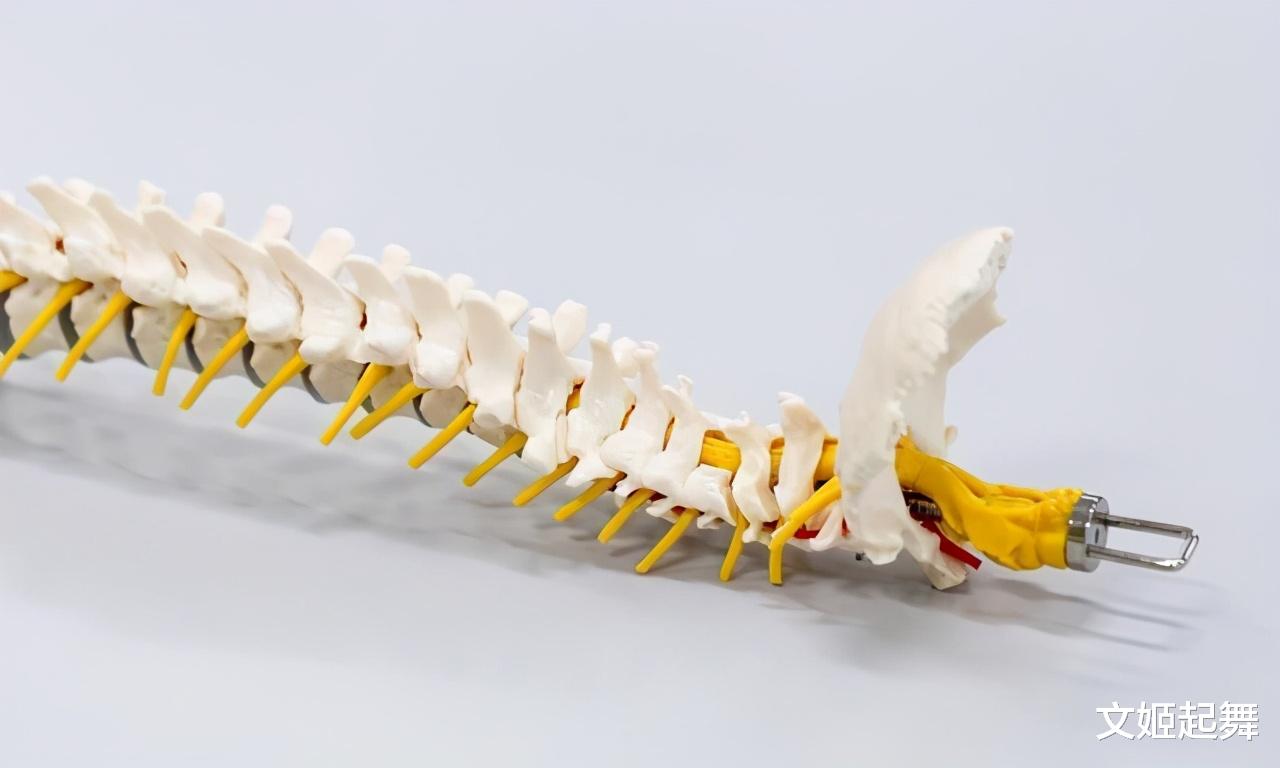 红枣|稳固骨质的“冠军”找到了，不是牛奶，没事敞开吃，提高骨密度