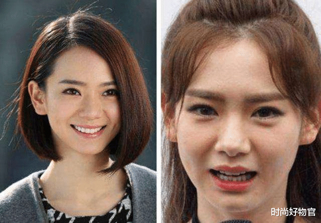 戚薇|一个被玻尿酸毁了的女星，如今38岁面目全非，年轻时五官精致耐看