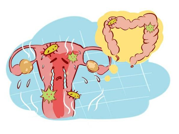 叙说人生故事 医生：女性腹部一旦出现2种迹象，说明子宫癌已来临，需尽早排查