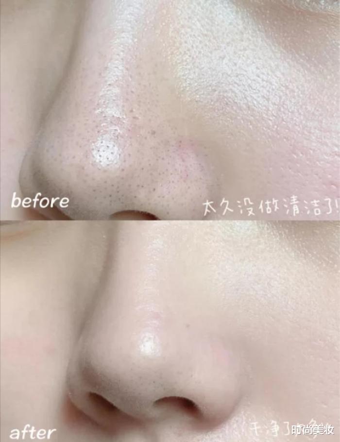 打底裤|中国“最有骨气”的护肤品，曾经国内已不承认，现在却与兰蔻并肩