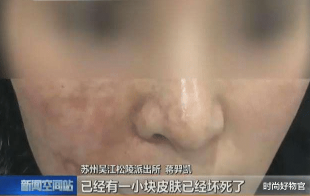 戚薇|一个被玻尿酸毁了的女星，如今38岁面目全非，年轻时五官精致耐看